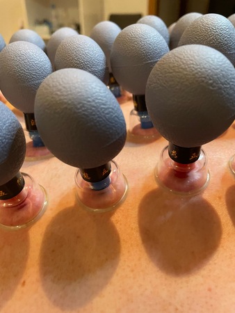 NEU! LAIMA. MEGABUSEN. Exklusiv: Detox Schröpf Massage, Kreuztal