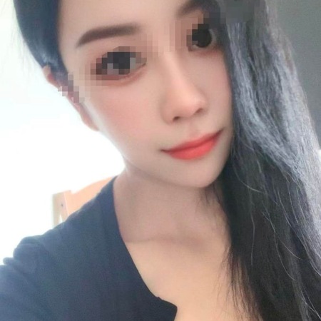 Neu lily aus Japan, Karben