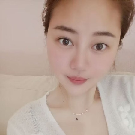 Xiaoxiao, Buseck