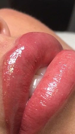 Loren DT Queen, Dresden